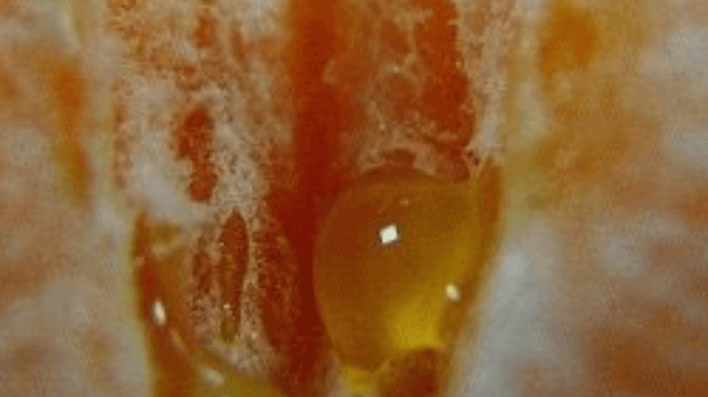 Why your Vaginal Microbiome Matters & Tips to Keep your Vagina Healthy