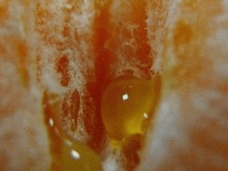 Why your Vaginal Microbiome Matters & Tips to Keep your Vagina Healthy