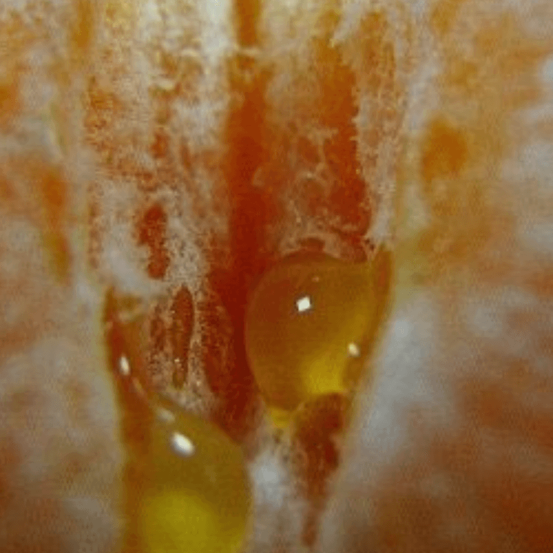 Why your Vaginal Microbiome Matters & Tips to Keep your Vagina Healthy